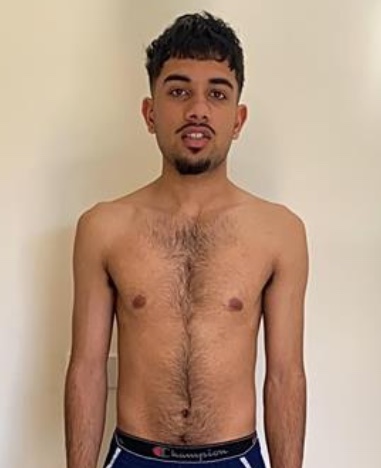 Client 60 kg up to 63 kg over 20 weeks, before